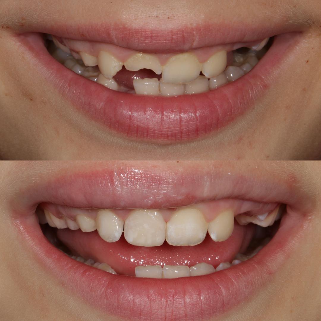casos clinicos dentales