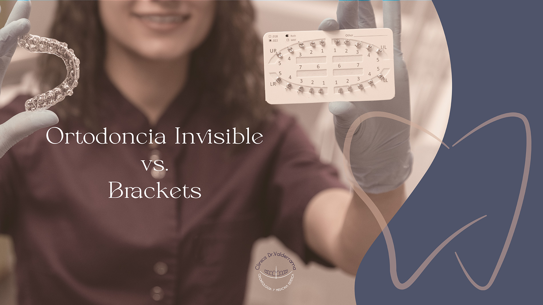 Ortodoncia Invisible vs. Brackets